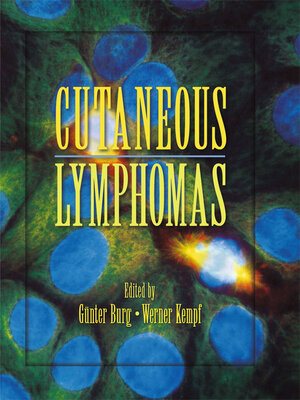 cover image of Cutaneous Lymphomas